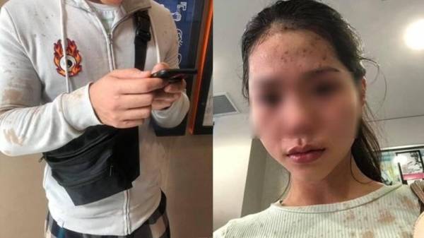 Cô gái gốc Việt và anh trai bị hất đồ uống, hành hung ở Úc vì đeo khẩu trang